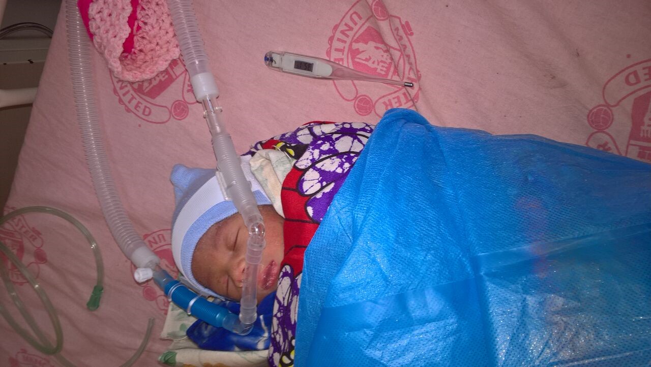 Baby with medical equipment