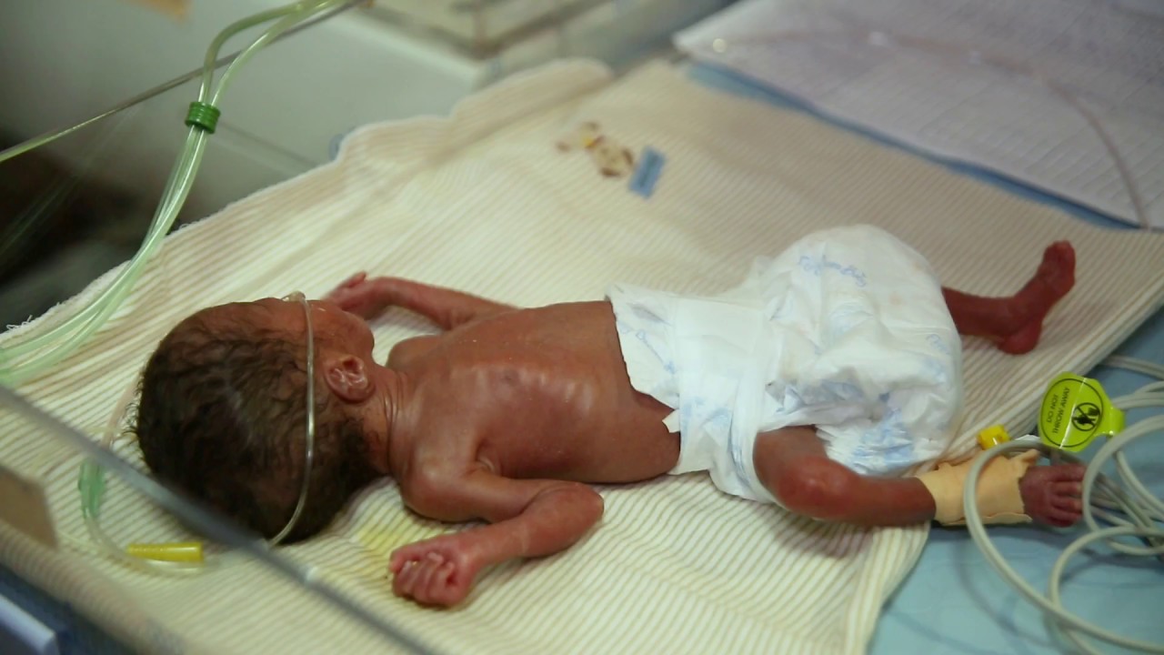 baby in hospital